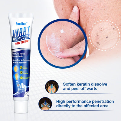 Wart Remover Treatment Cream